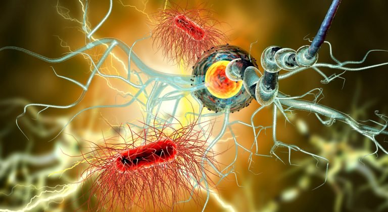 Breakthrough Trial For Motor Neuron Disease Medical Update Online