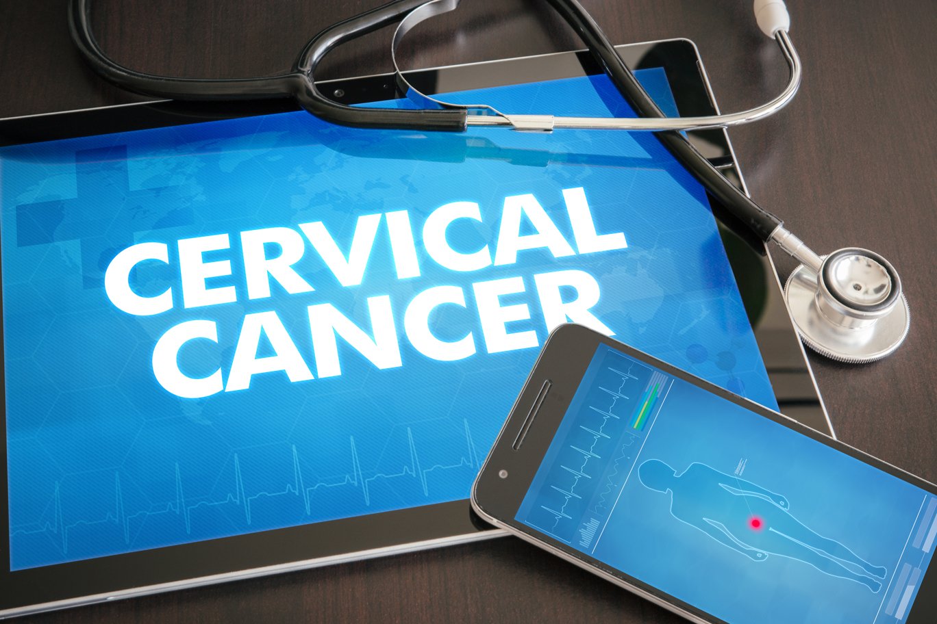 Adjuvant chemotherapy does not improve mortality in locally advanced ...