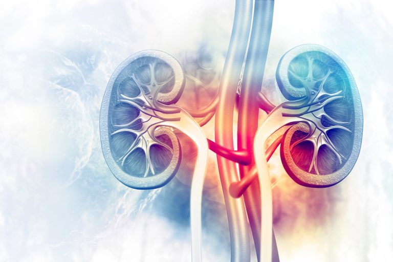 FDA Approves Kerendia In Chronic Kidney Disease (CKD) Associated With ...