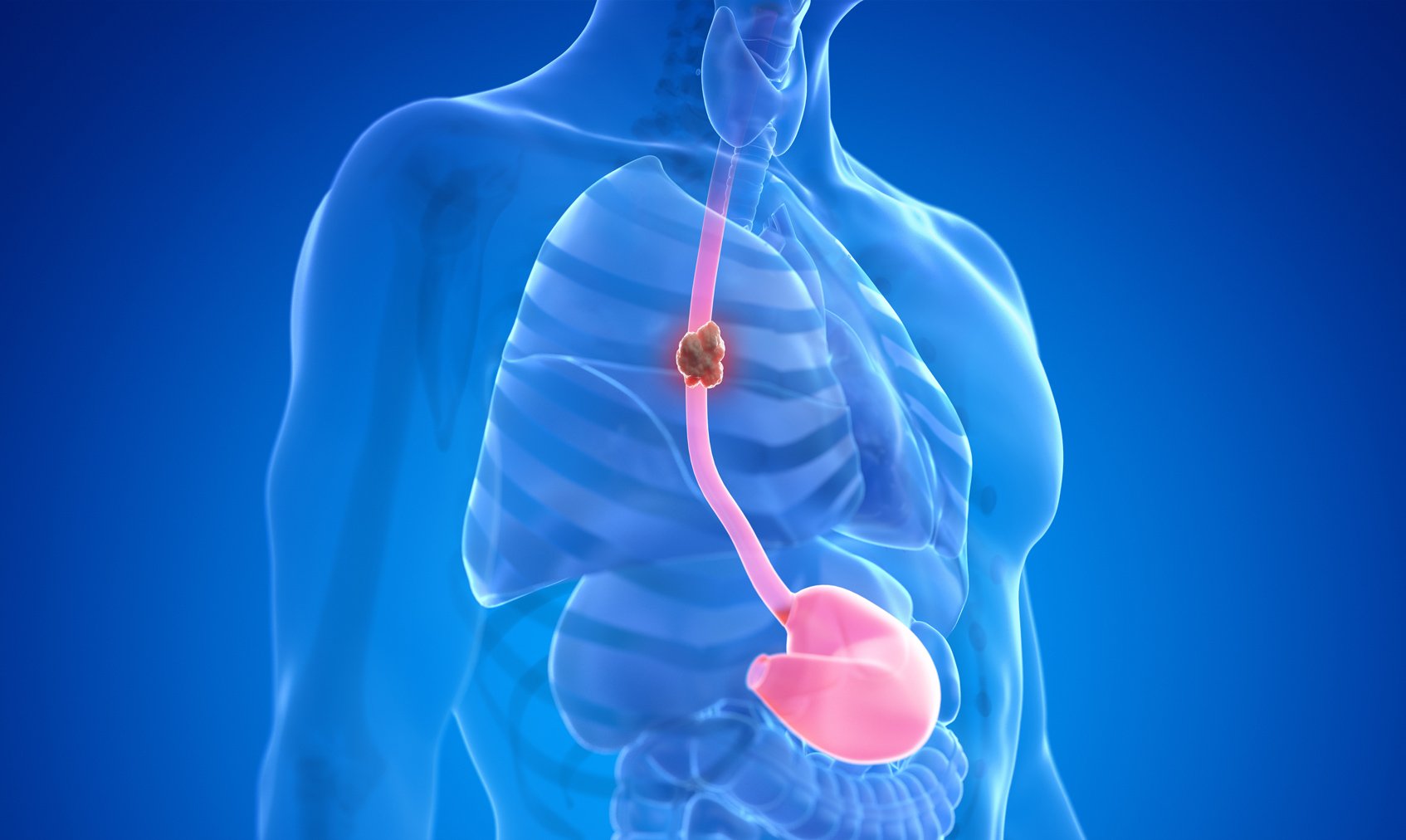 What Is First Line Treatment For Emphysema