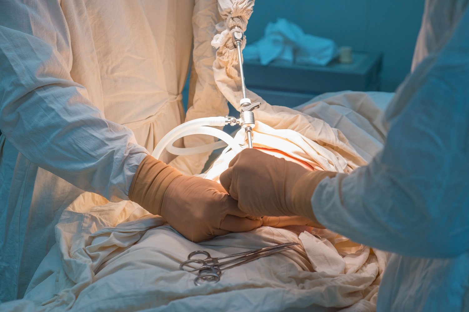 Bariatric surgery cuts cancer risks significantly - Medical Update Online