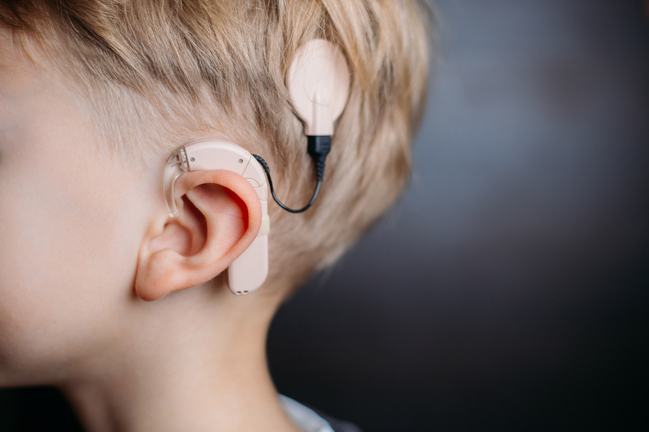 diagnosis helps guide care of childhood hearing loss Medical Update Online