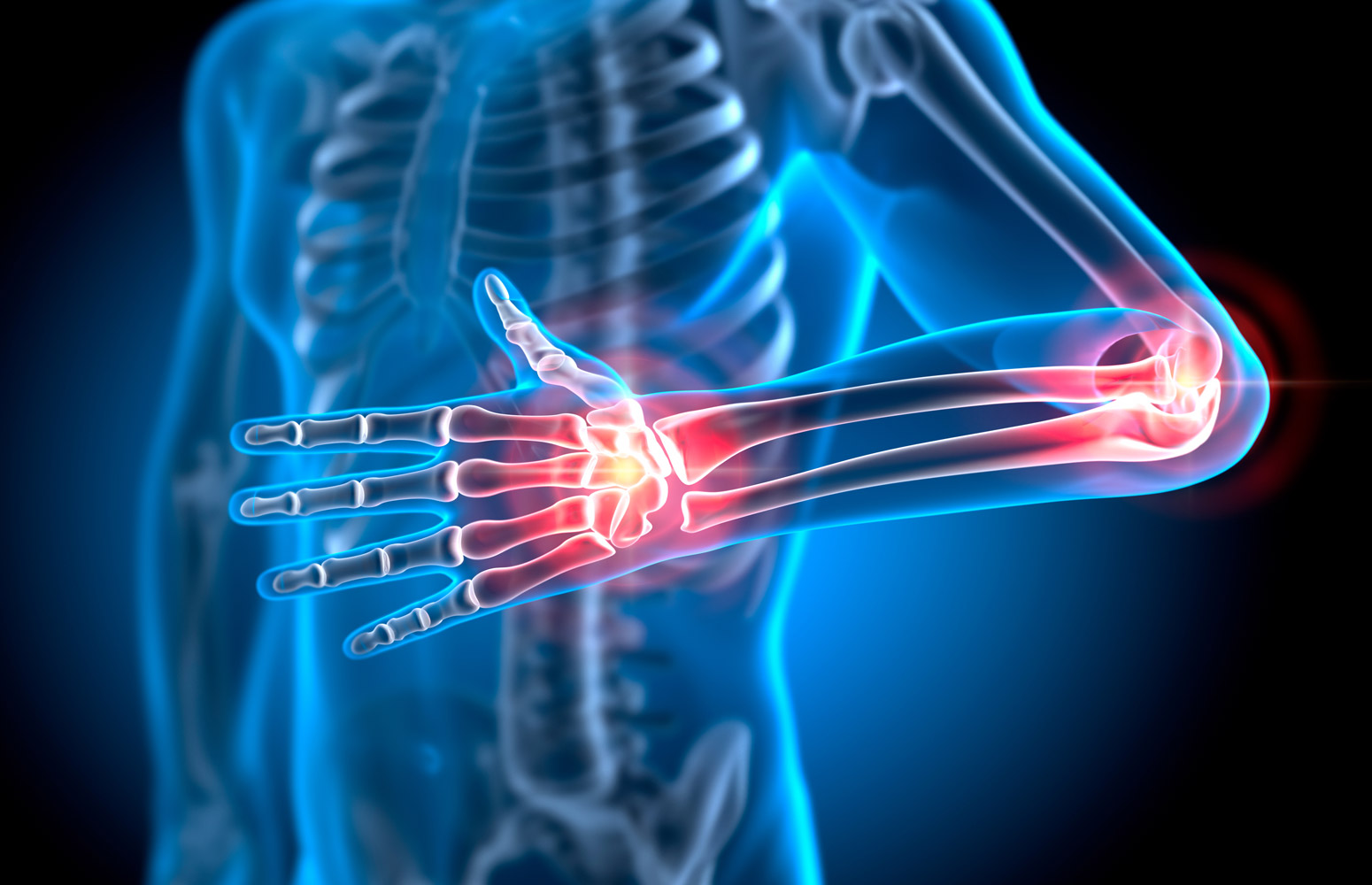 New breakthrough in the treatment of rheumatoid arthritis Medical